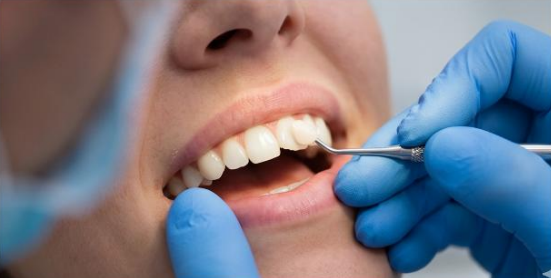 Dental Bonding